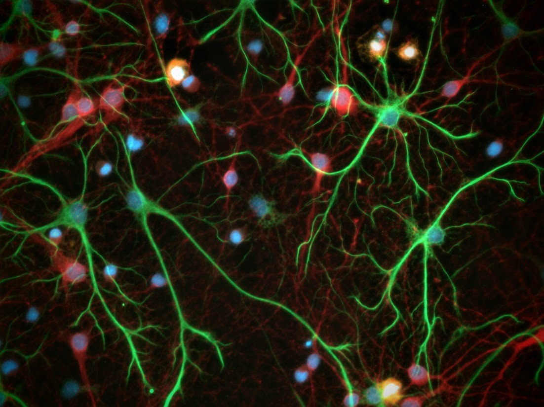 A magnified image of the tri-culture cells